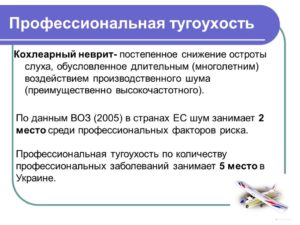 Лечение кохлеарного неврита