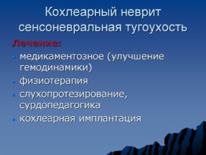 Лечение кохлеарного неврита