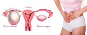 Боли в яичниках после эскапела
