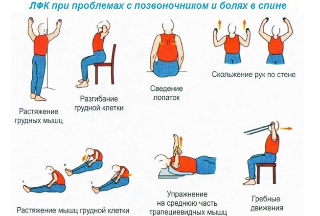 Лечебная гимнастика для спины и позвоночника Гимнастика для спины и позвоночника