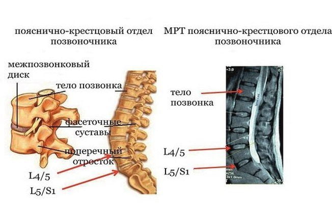 Строение пояснично-крестцового отдела позвоночника Пояснично-крестцовый отдел позвоночника
