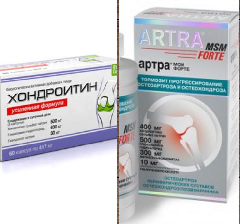 Препараты Артра и Хондроитин Артра и Хондроитин