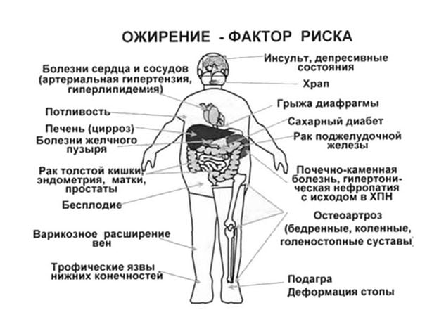 Влияние ожирения на огранизм Ожирение
