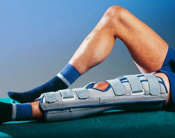 Фиксация колена при гемартрозе Фиксация колена