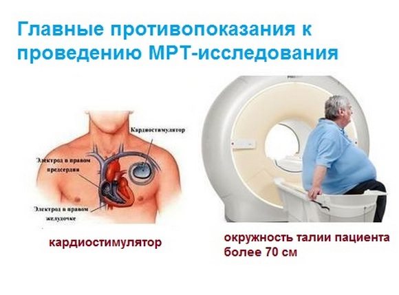 Основные противопоказания к проведению МРТ Противопоказания к проведению МРТ