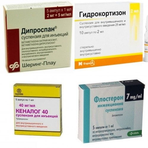 Глюкокортикоидные препараты при артрозе Глюкокортикоидные препараты