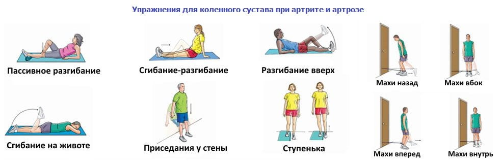 Упражнения для коленного сустава при артрите, артрозе Упражнения для колена