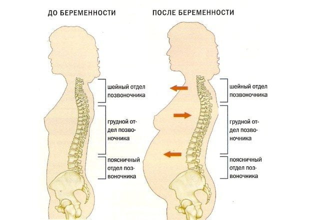 Влияние беременности на позвоночник Позвоночник беременной