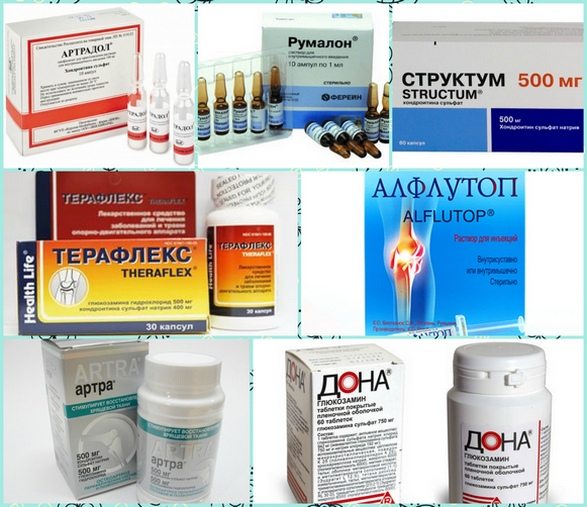 Хондропротекторные препараты для лечения остеохондроза и других заболеваний позвоночника и суставов Разные хондропротекторы