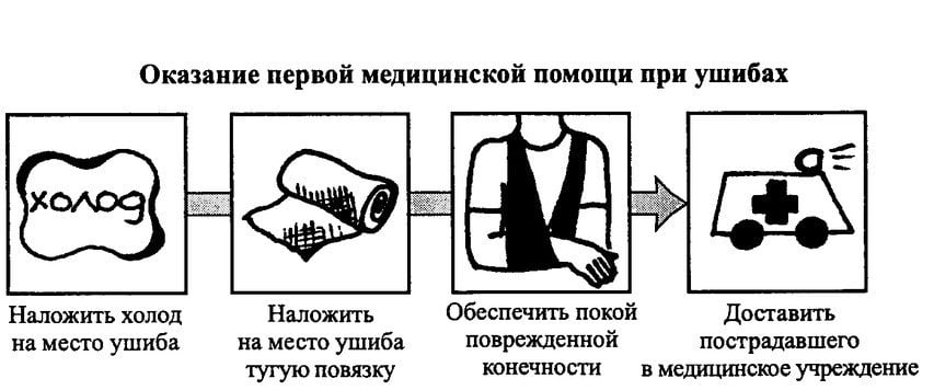 Оказание первой медицинской помощи при ушибах Первая помощь при ушибах