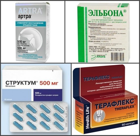 Хондропротекторы для лечения суставов - Артра, Эльбона, Структум, Терафлекс Хондропротекторы