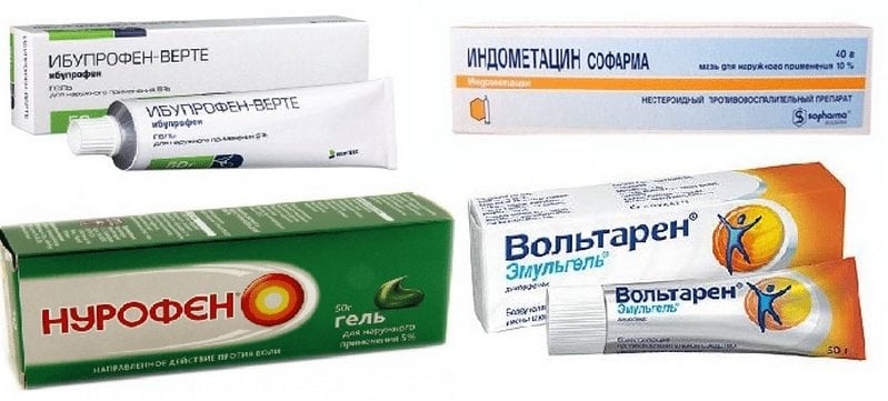 Противовоспалительные мази при артрозе суставов Противовоспалительные мази при артрозе
