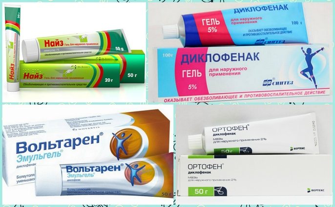 Некоторые противовоспалительные мази от суставных болей Противовоспалительные мази