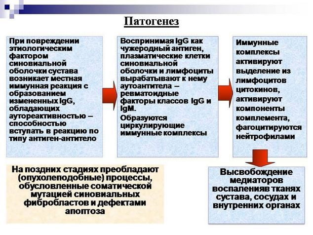 Патогенез ревматоидного артрита Патогенез РА
